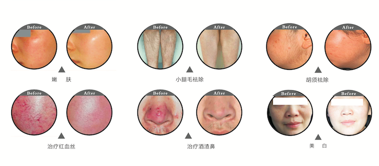 亚格